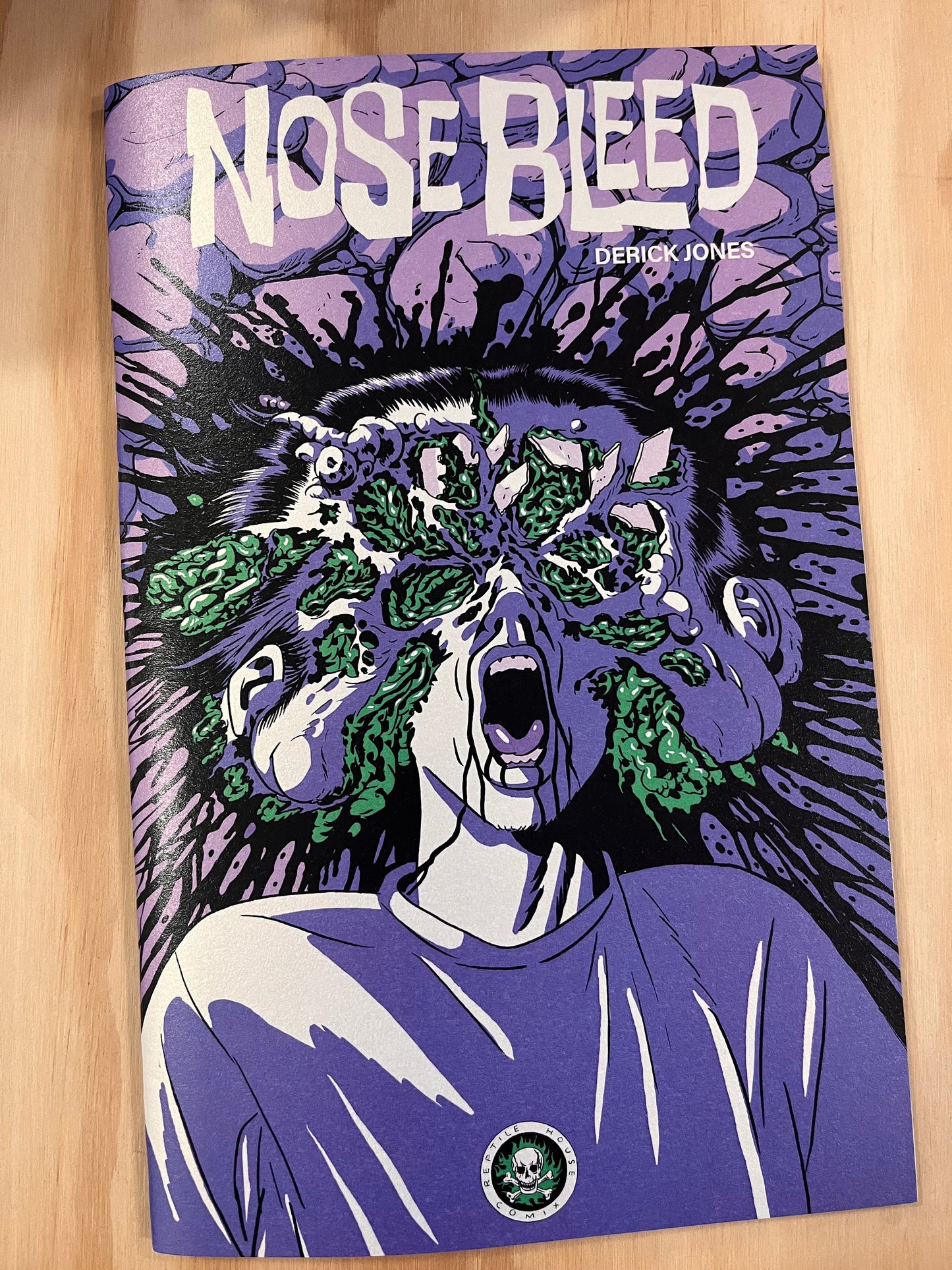 Nose Bleed