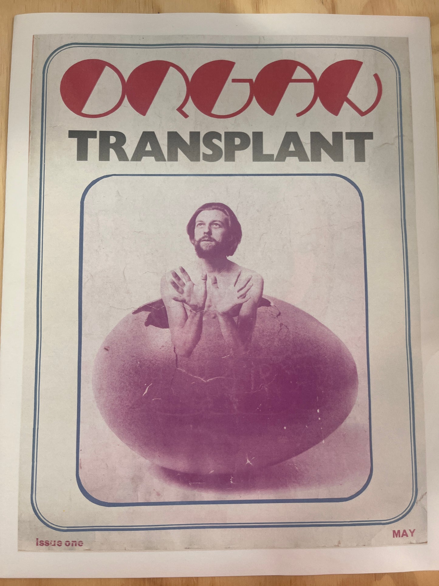 Organ Transplant #1