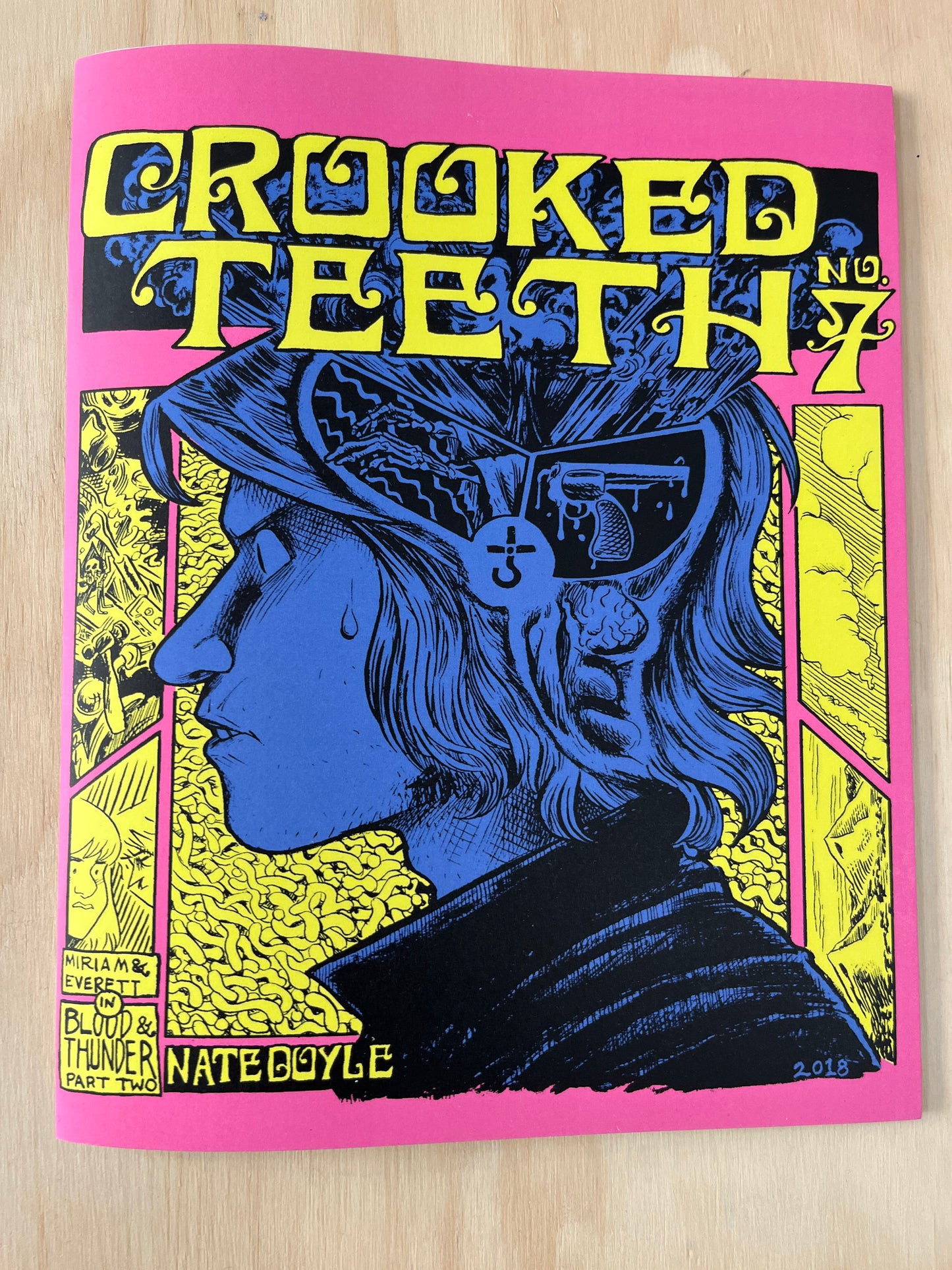 Crooked Teeth #7