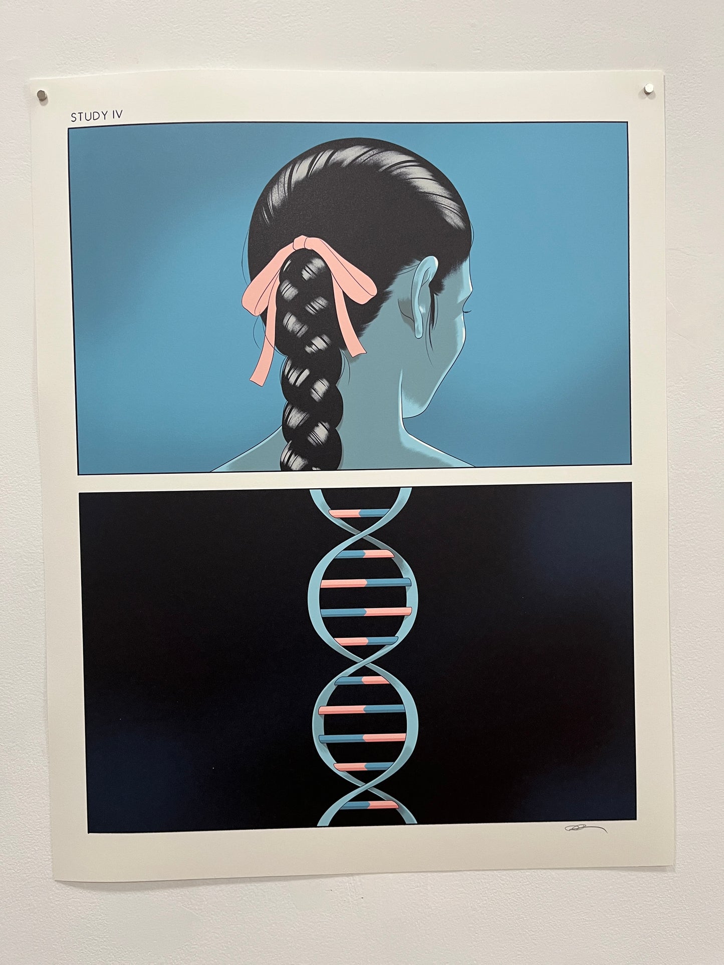 Anuj Shrestha: Study IV