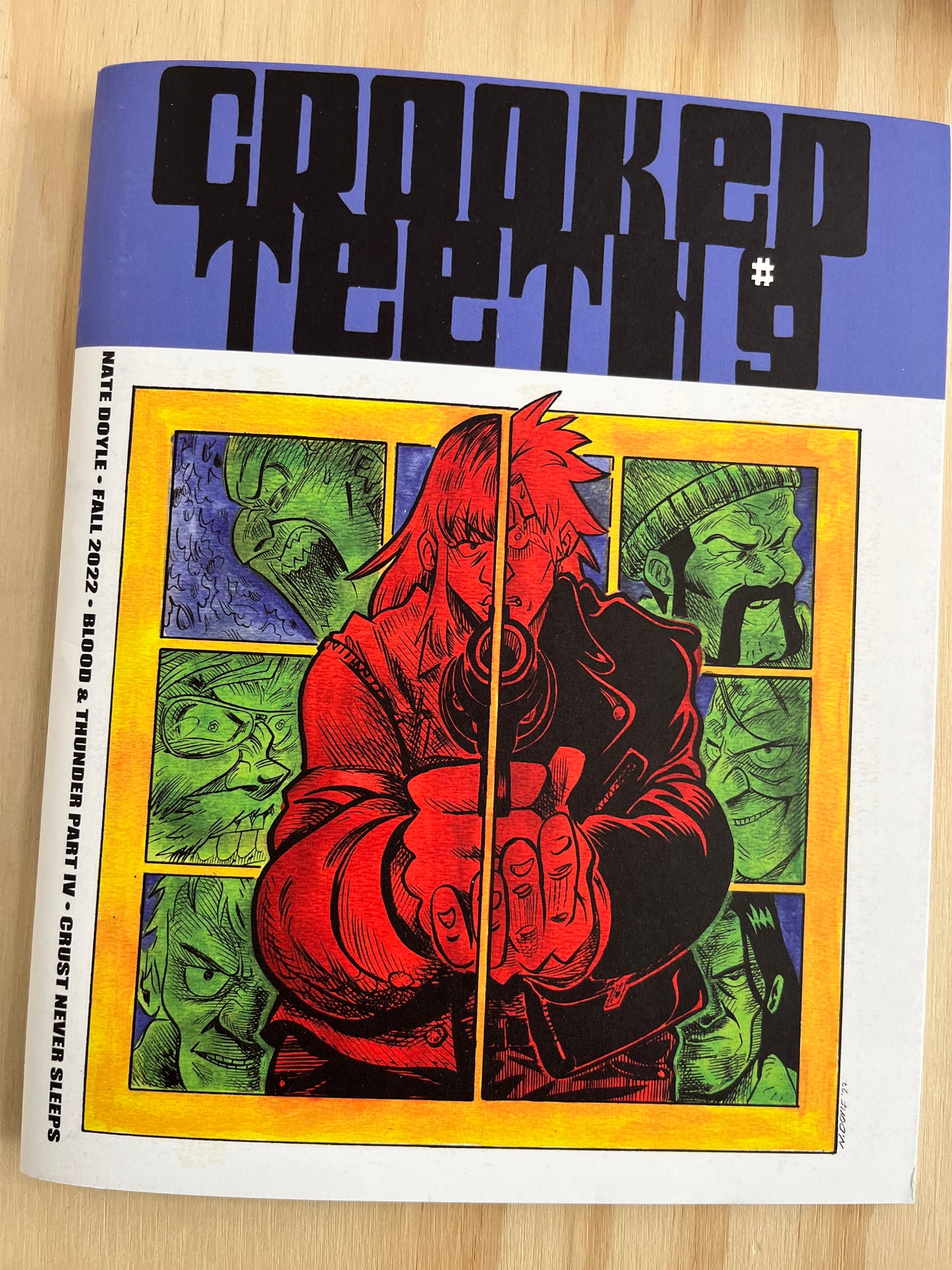Crooked Teeth #9