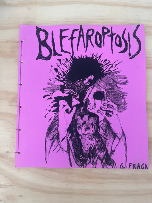 Blefaroptosis