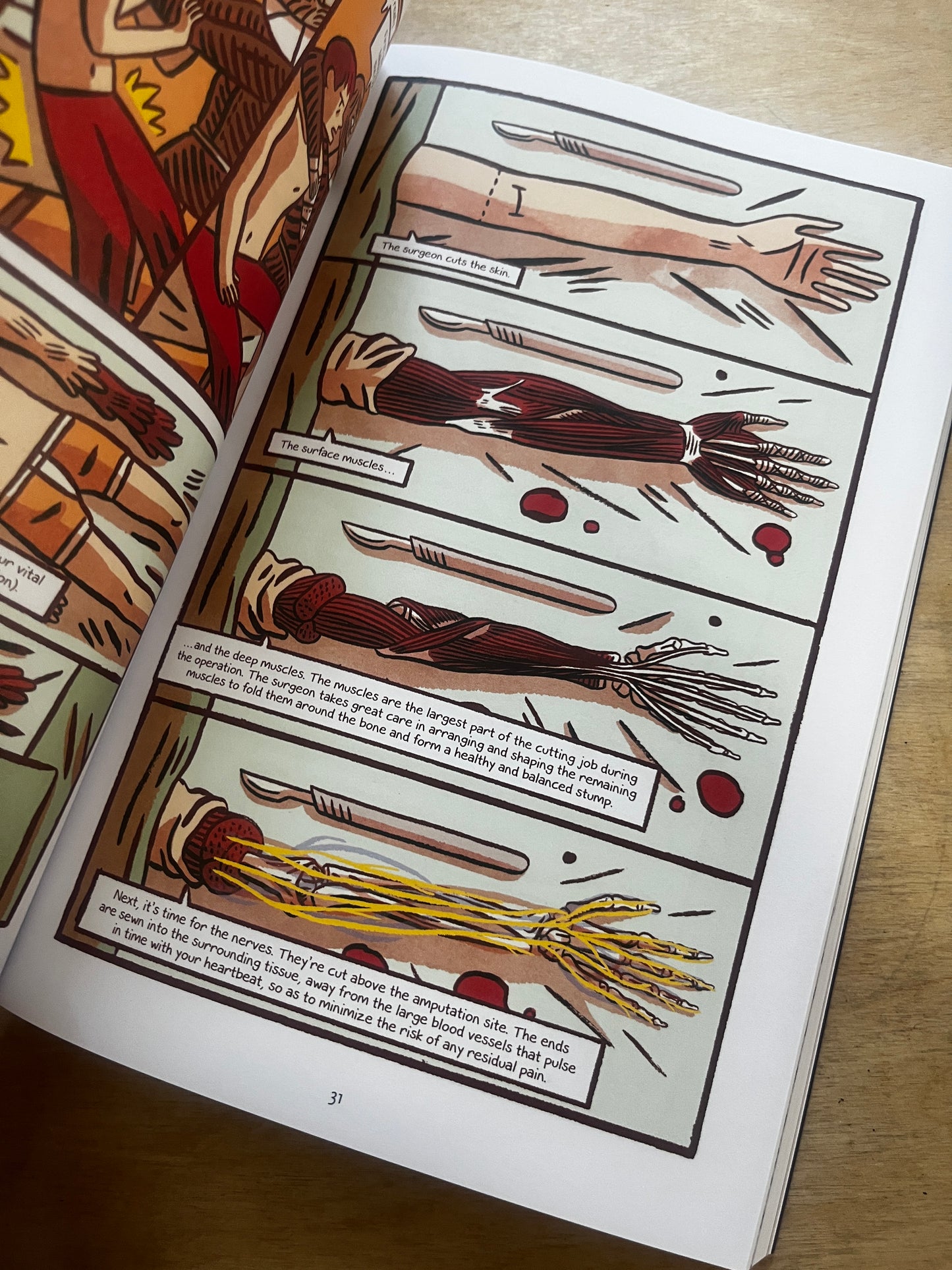 The Body Factory  From the First Prosthetics to the Augmented Human